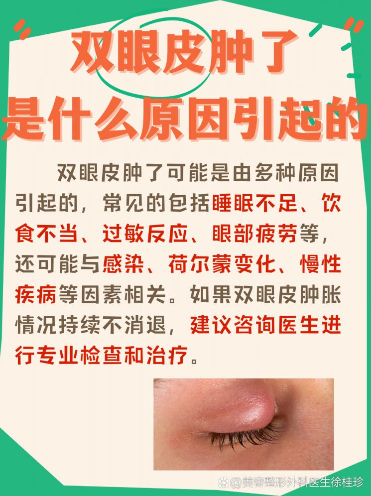 揭秘双眼皮肿胀原因，快速恢复明亮双眼！