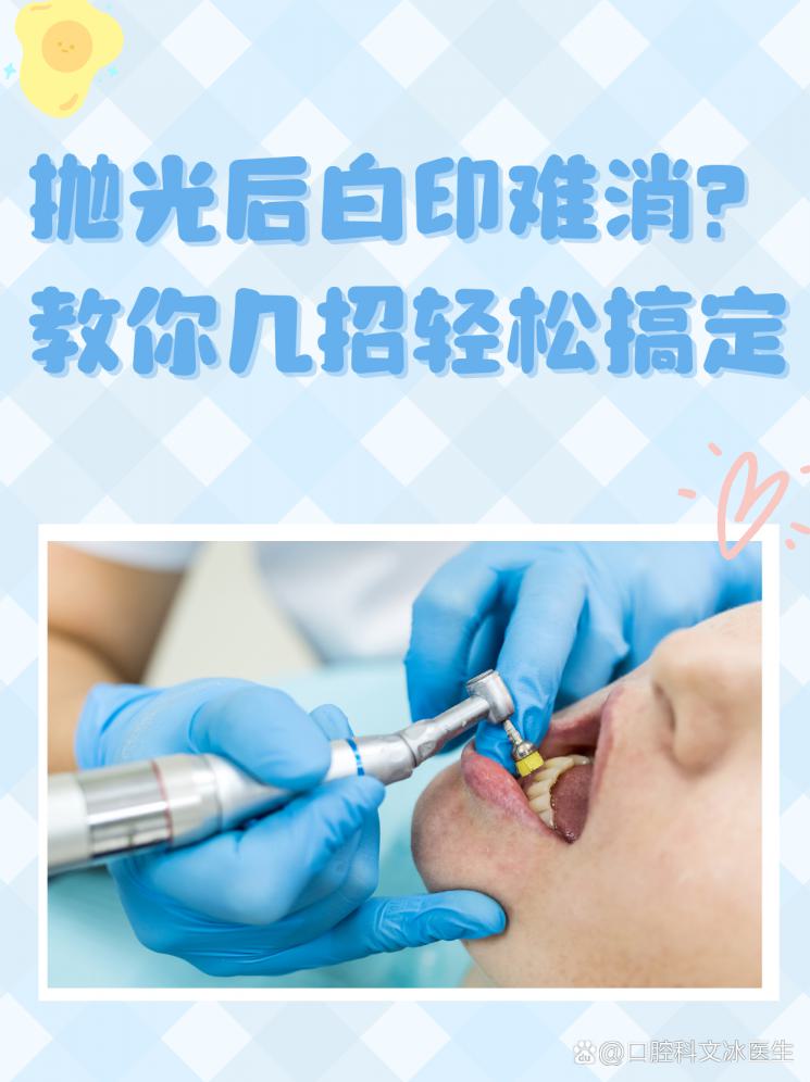 抛光后白印难消？教你几招轻松搞定