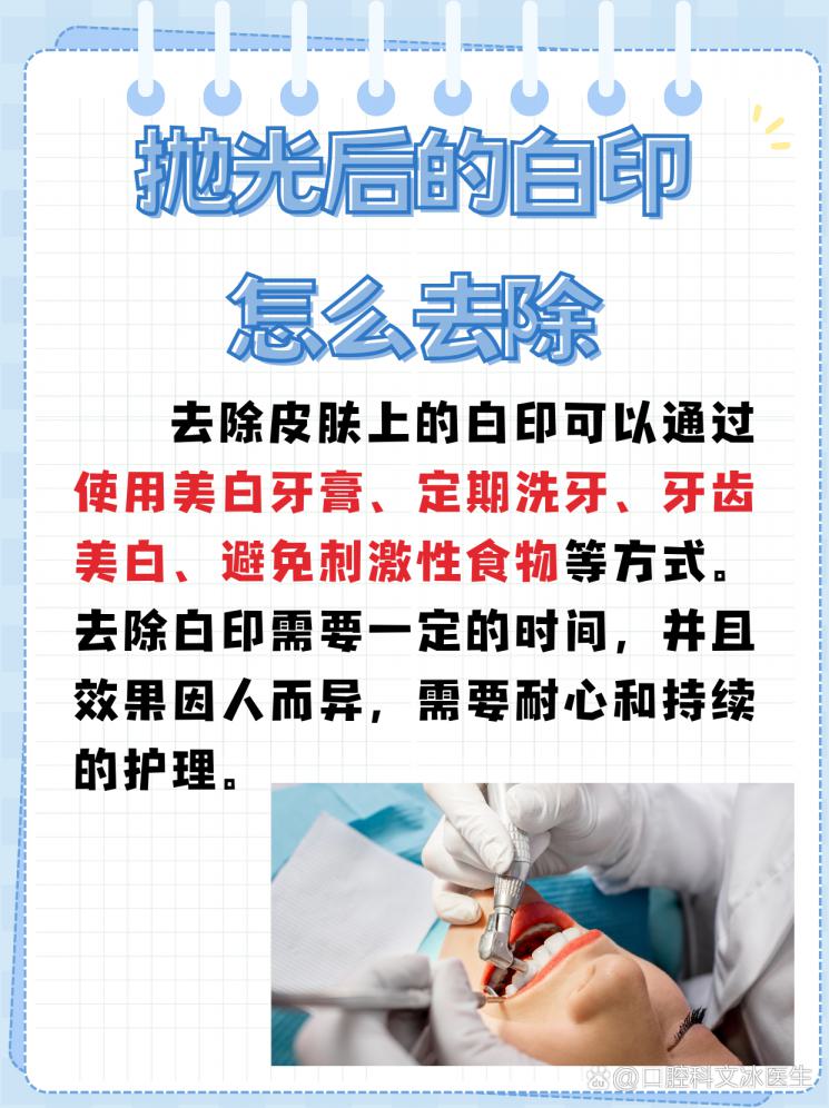 抛光后白印难消？教你几招轻松搞定