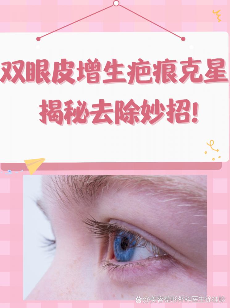 双眼皮增生疤痕克星，揭秘去除妙招！