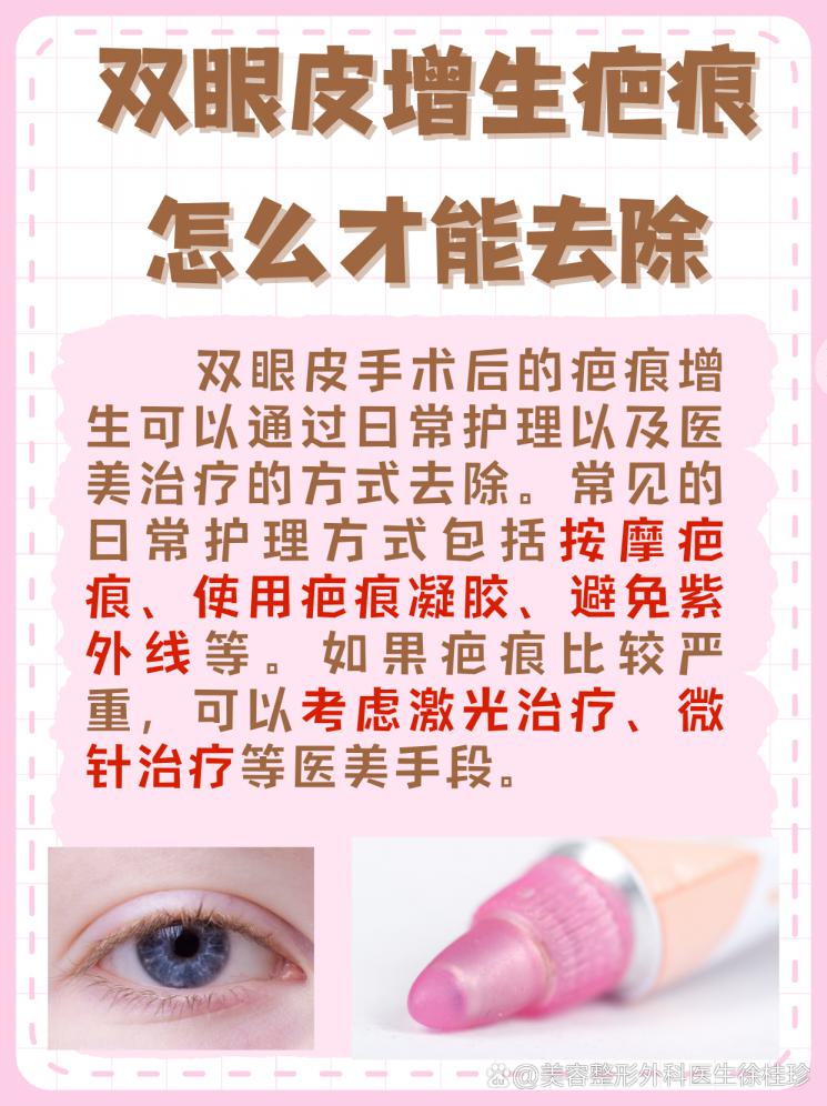 双眼皮增生疤痕克星，揭秘去除妙招！