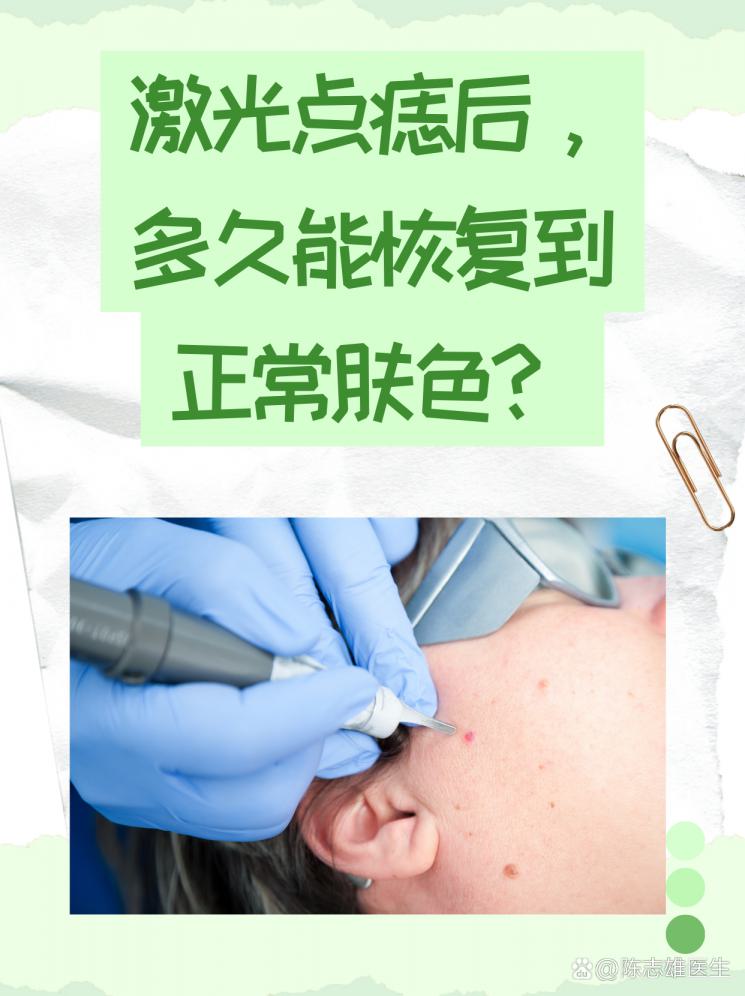 激光点痣后，多久能恢复到正常肤色？