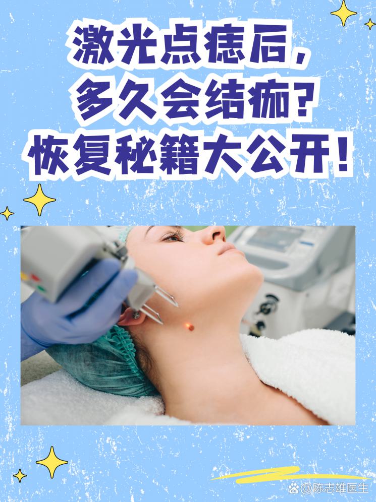 激光点痣后，多久会结痂？恢复秘籍大公开！