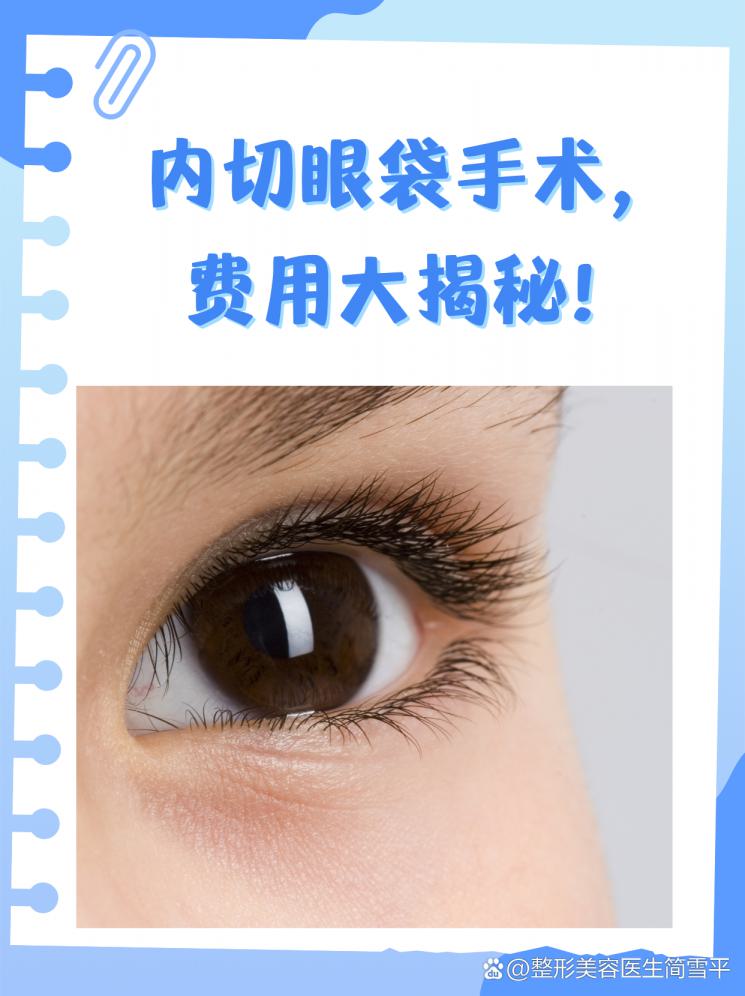 内切眼袋手术，费用大揭秘！