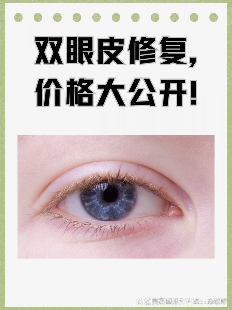 双眼皮修复，价格大公开！