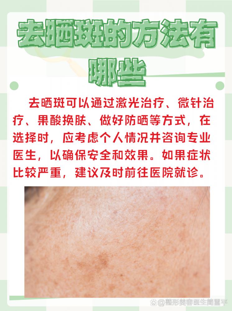 夏日晒斑不用愁，医美医生教你轻松应对！