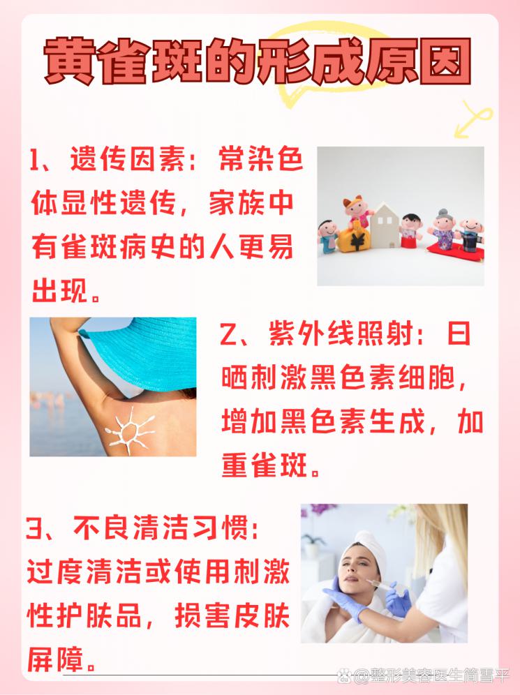 黄雀斑退散！简单有效的淡斑秘籍大公开