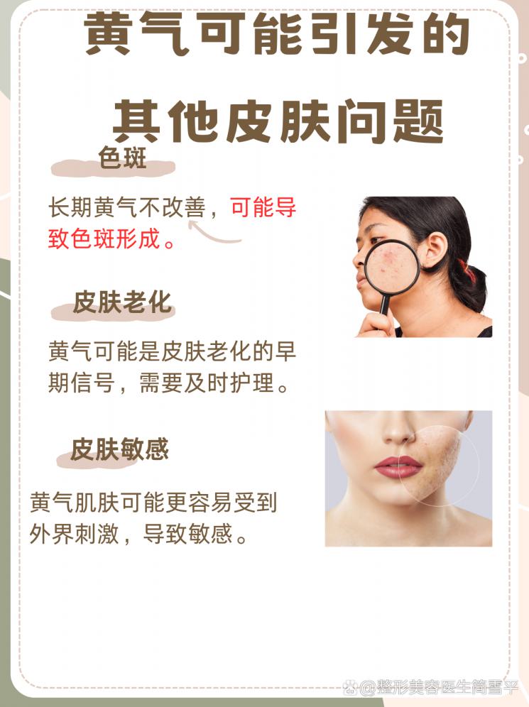 黄气退散！揭秘肤色提亮的黄金法则