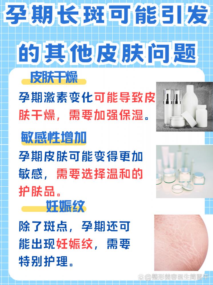 孕期斑点烦恼？揭秘祛斑秘籍
