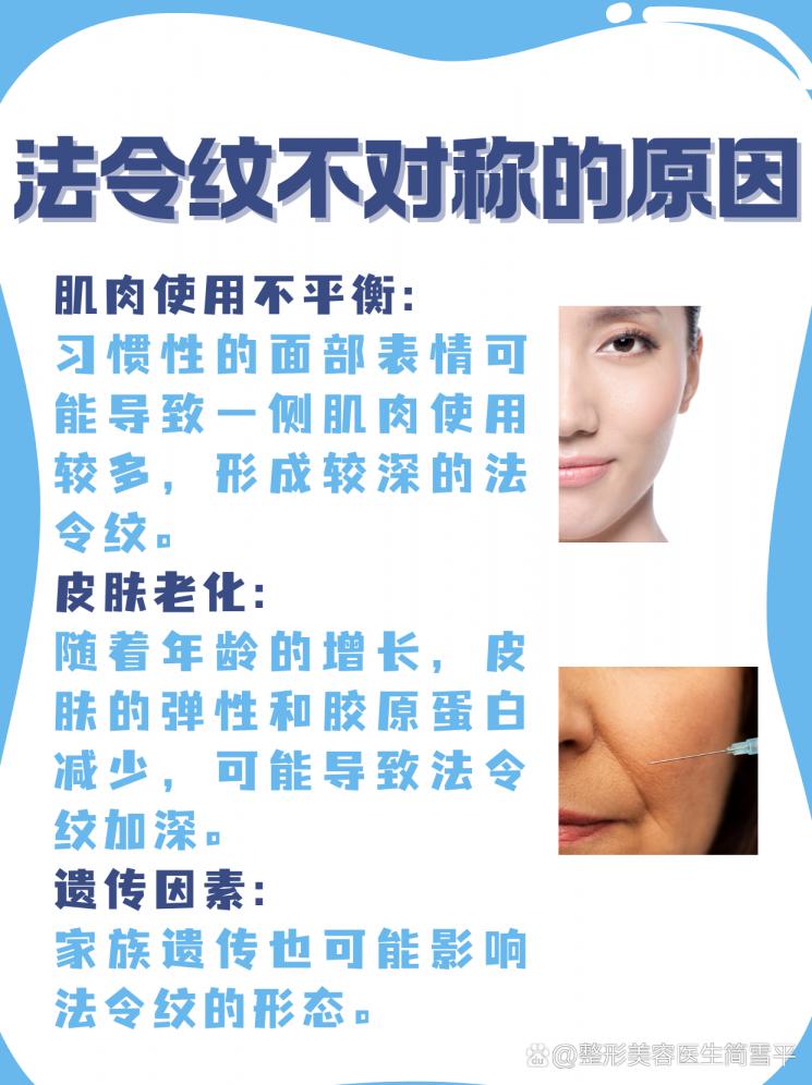 法令纹不对称：揭秘原因与改善策略