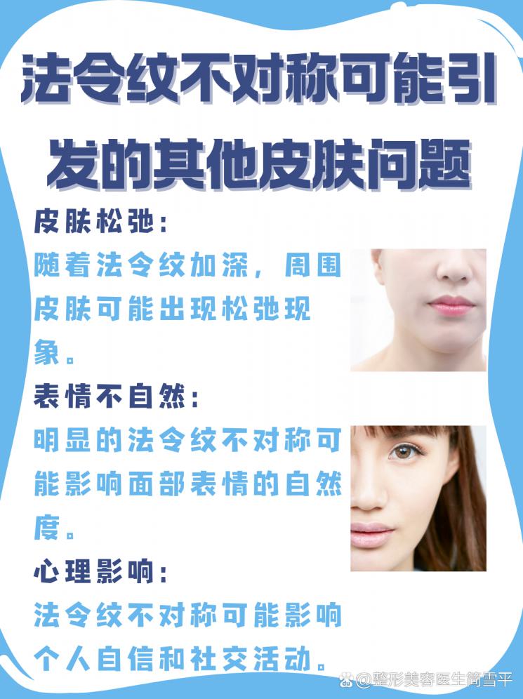 法令纹不对称：揭秘原因与改善策略