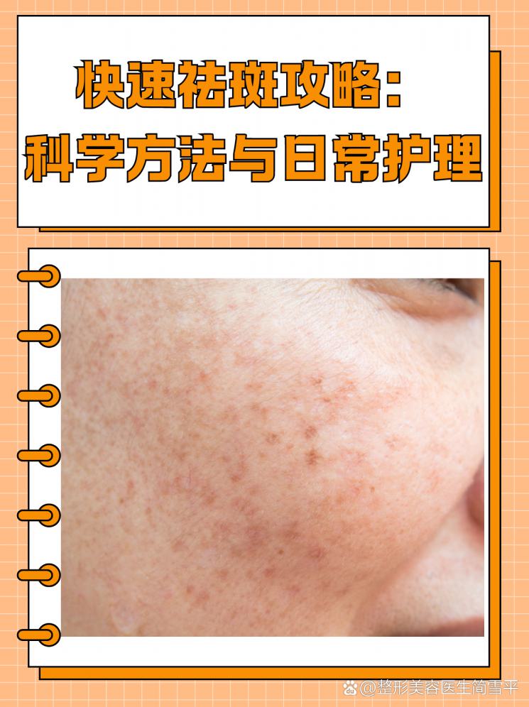快速祛斑攻略：科学方法与日常护理