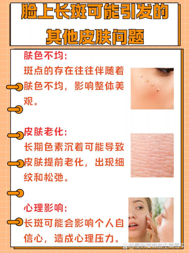 快速祛斑攻略：科学方法与日常护理