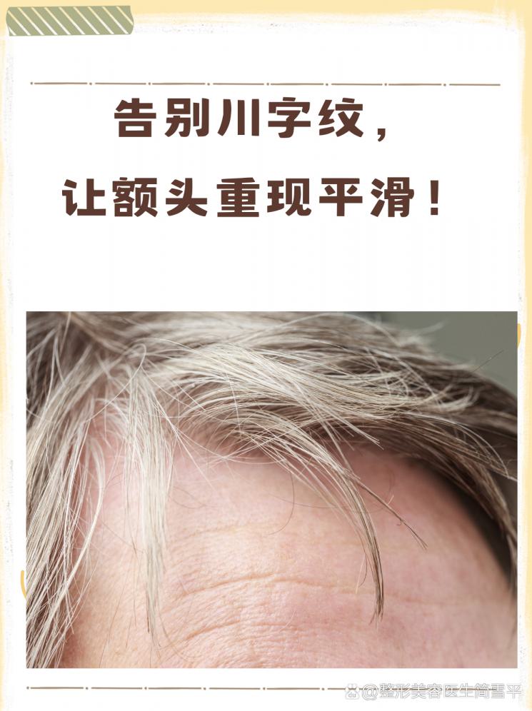 告别川字纹，让额头重现平滑！