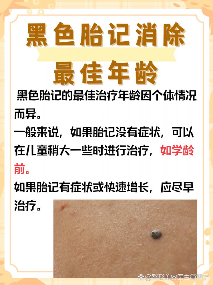 黑色胎记：何时治疗