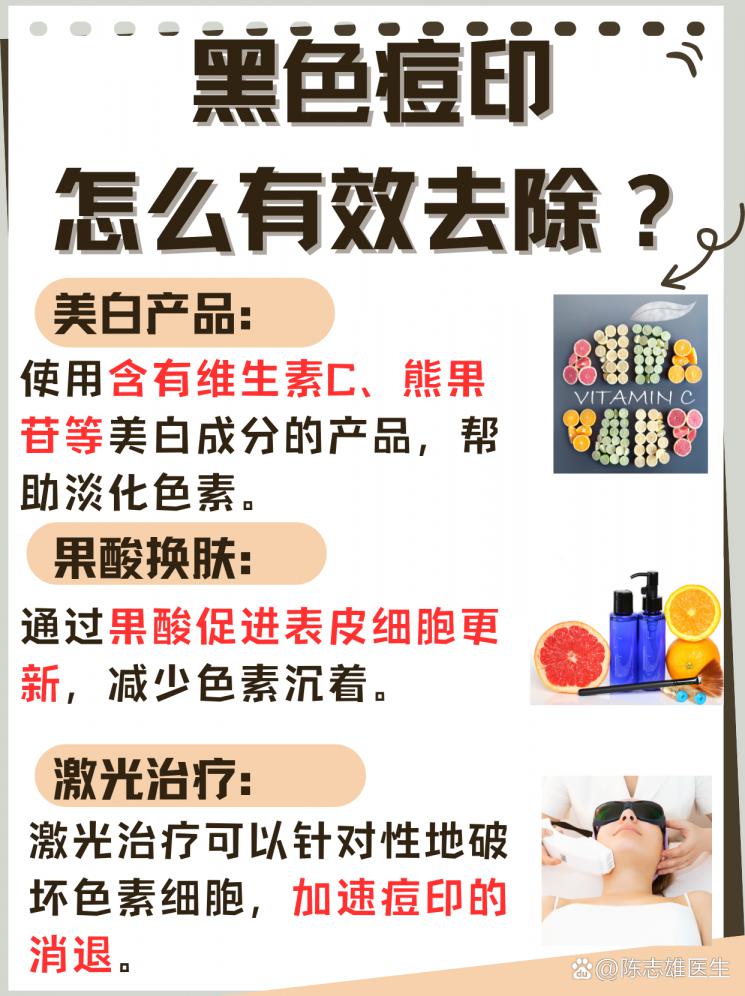 黑色痘印：最有效的去除方法大公开！