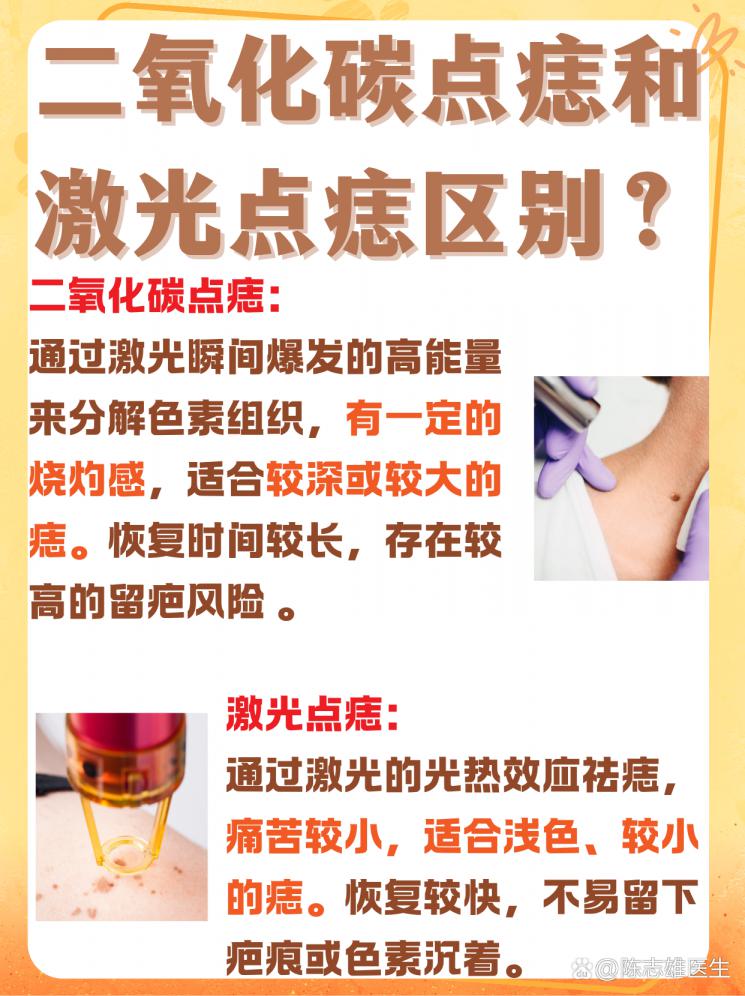 二氧化碳点痣VS激光点痣，揭秘两者区别！