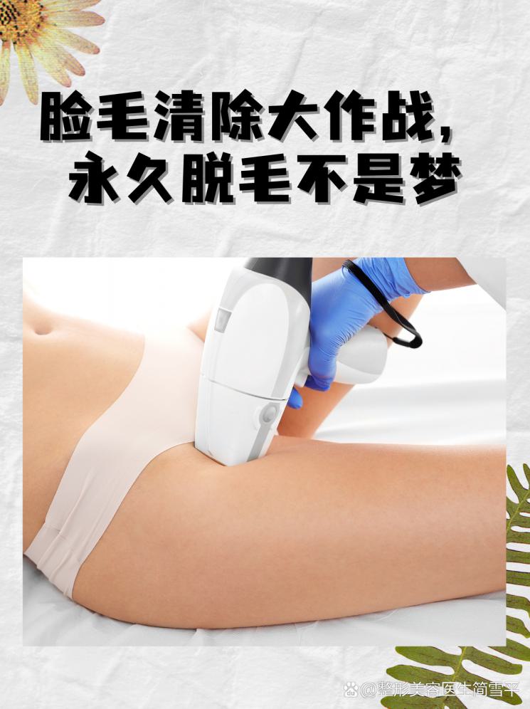 脸毛清除大作战，永久脱毛不是梦