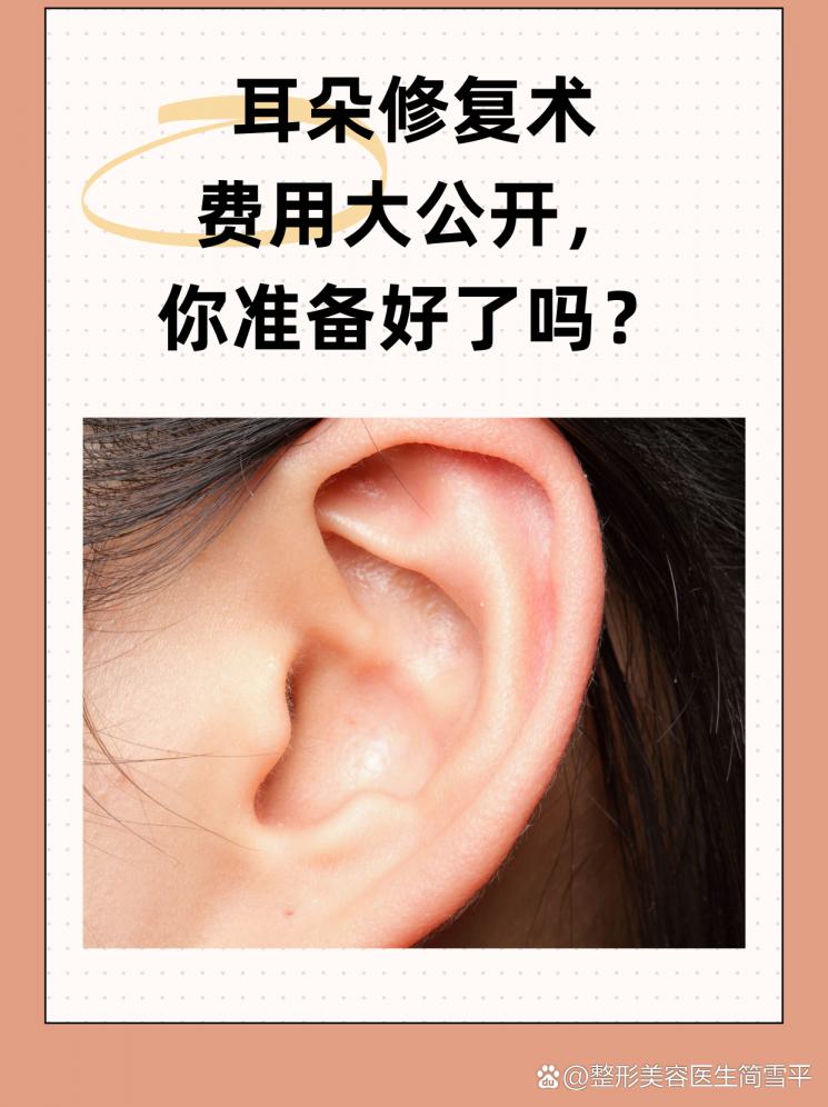耳朵修复术费用大公开，你准备好了吗？