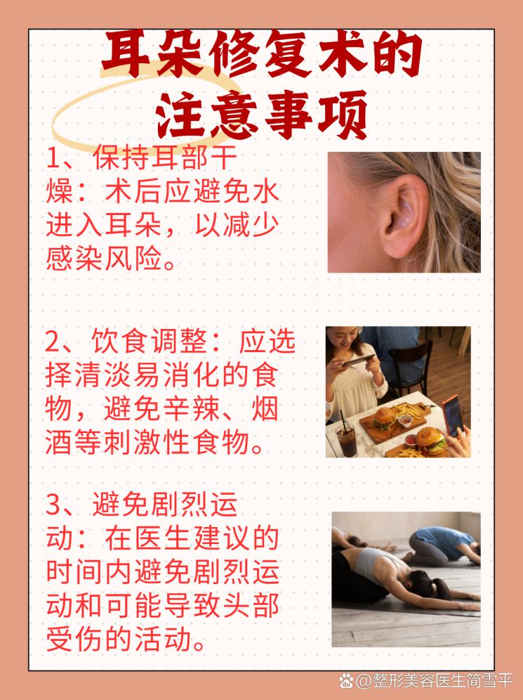 耳朵修复术费用大公开，你准备好了吗？