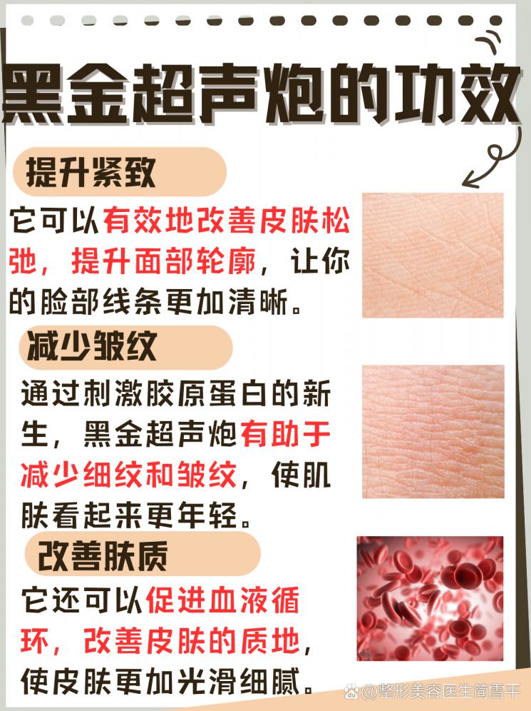 黑金超声炮：肌肤紧致提升的秘诀