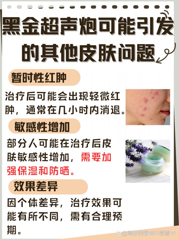 黑金超声炮：肌肤紧致提升的秘诀