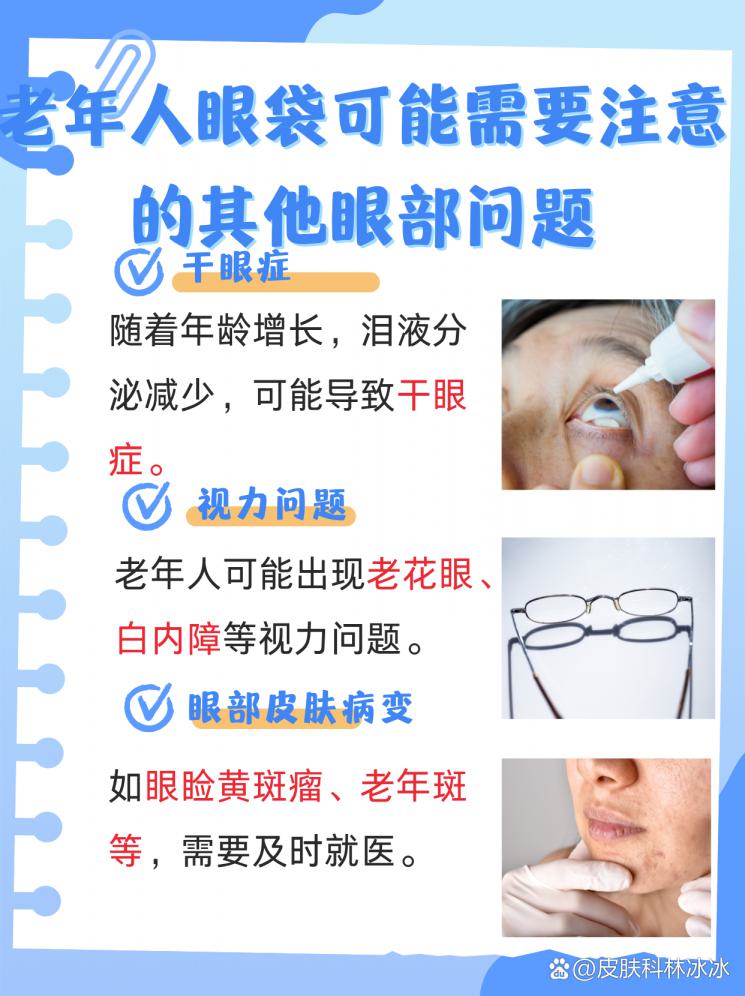 老年眼袋不用愁，消除妙招在这里