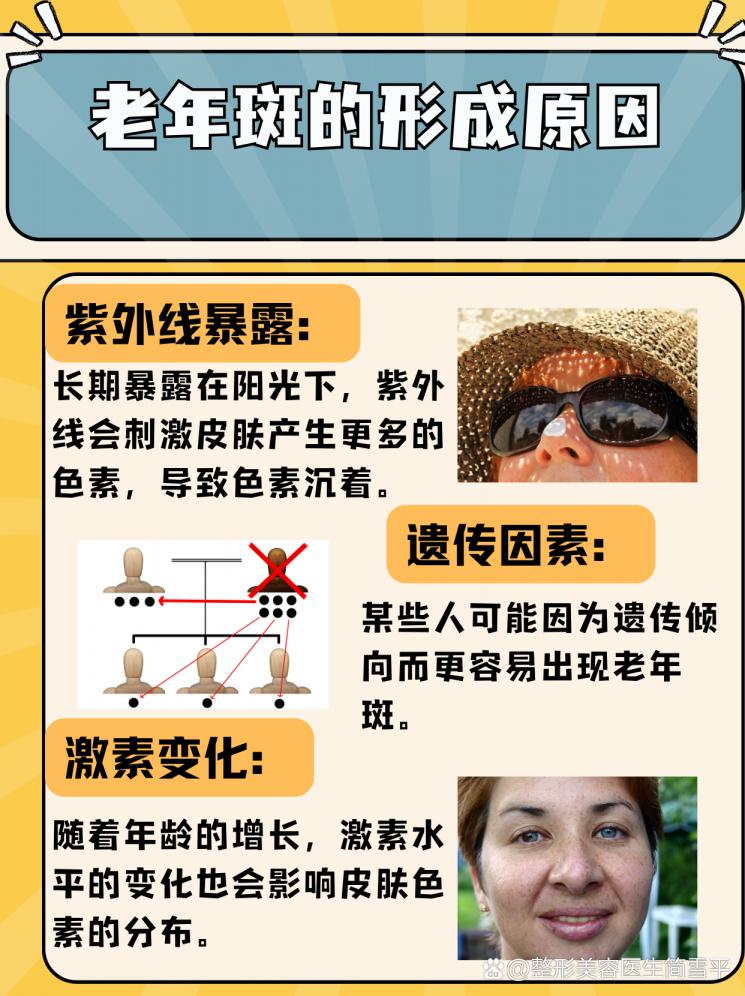 简单几步，和老年斑说拜拜！
