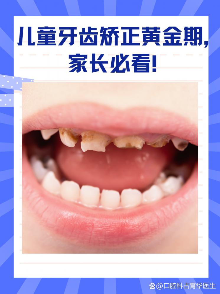 儿童牙齿矫正黄金期，家长必看！