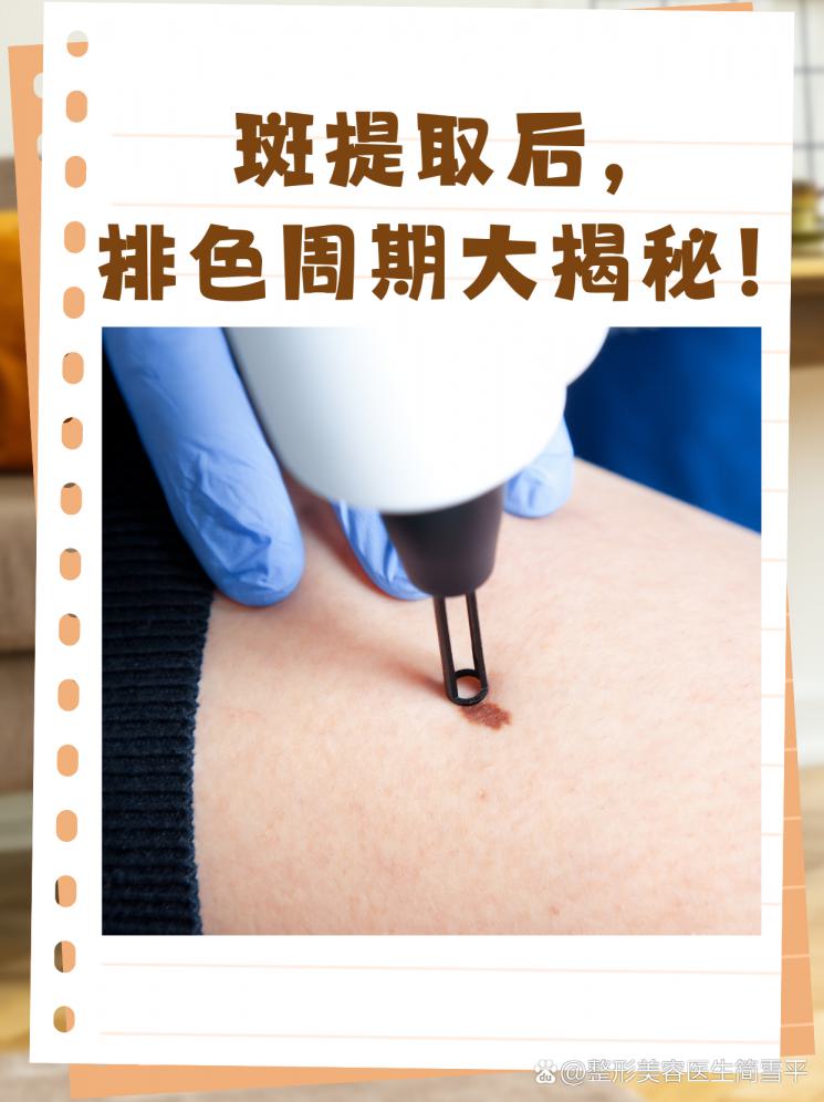 斑提取后，排色周期大揭秘！