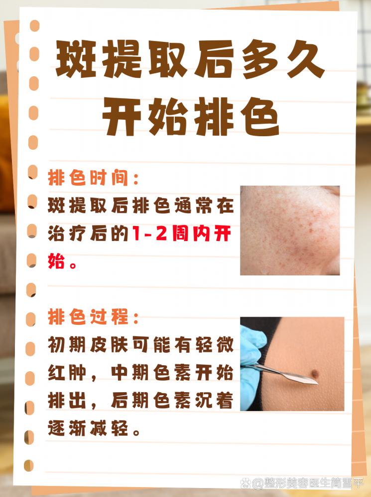斑提取后，排色周期大揭秘！