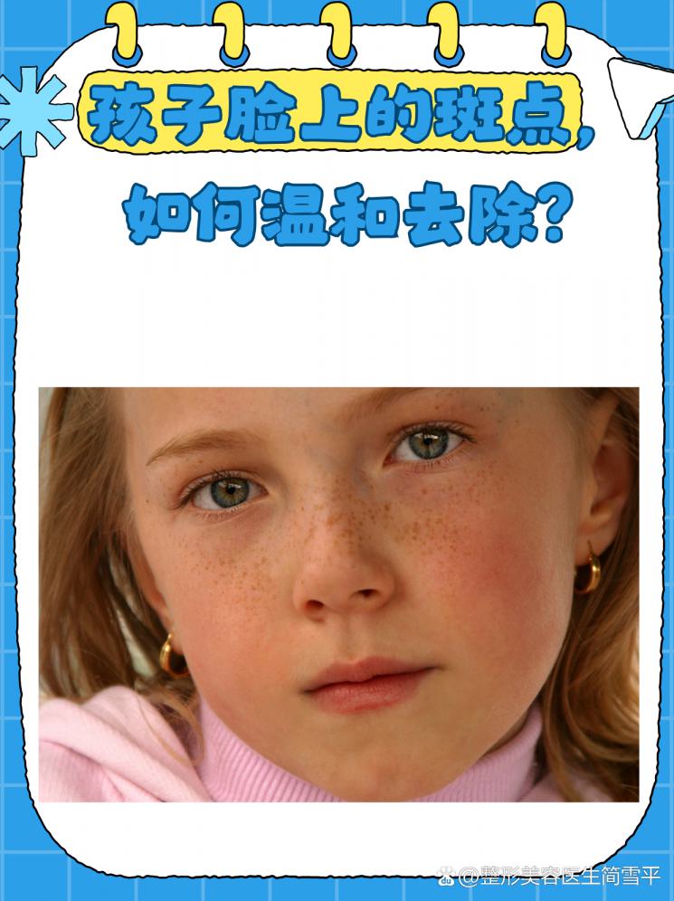 孩子脸上的斑点，如何温和去除？