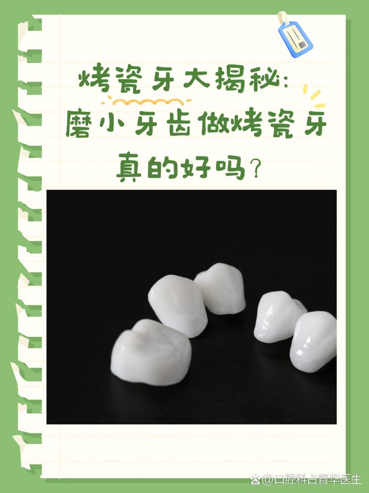 烤瓷牙大揭秘：磨小牙齿做烤瓷牙真的好吗？