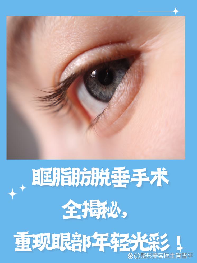眶脂肪脱垂手术全揭秘，重现眼部年轻光彩！