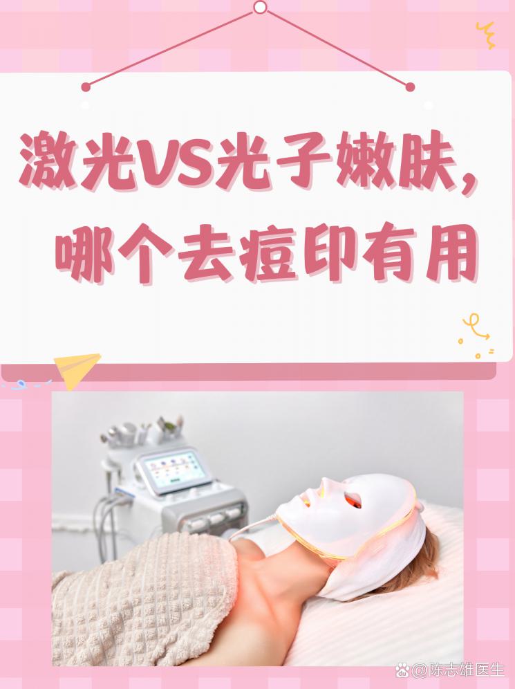 激光VS光子嫩肤，哪个去痘印有用？
