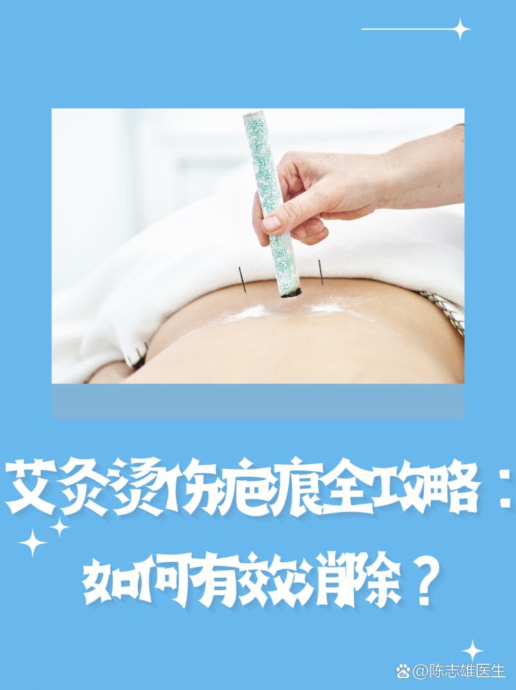 艾灸烫伤疤痕全攻略：如何有效消除？