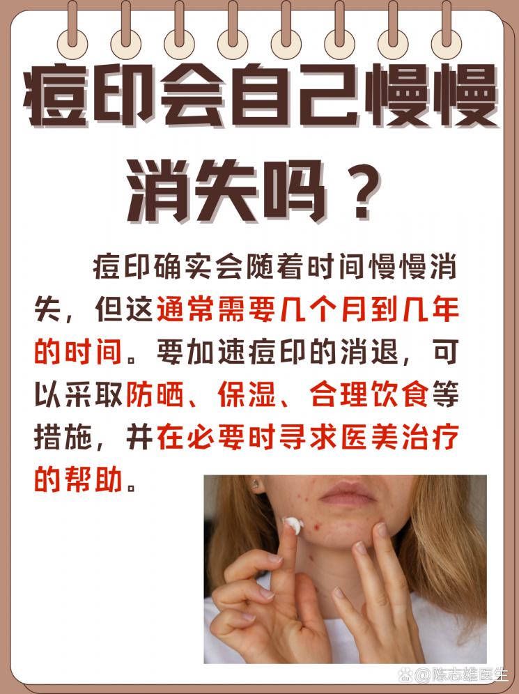 痘印会自己慢慢消失吗？带你揭秘！