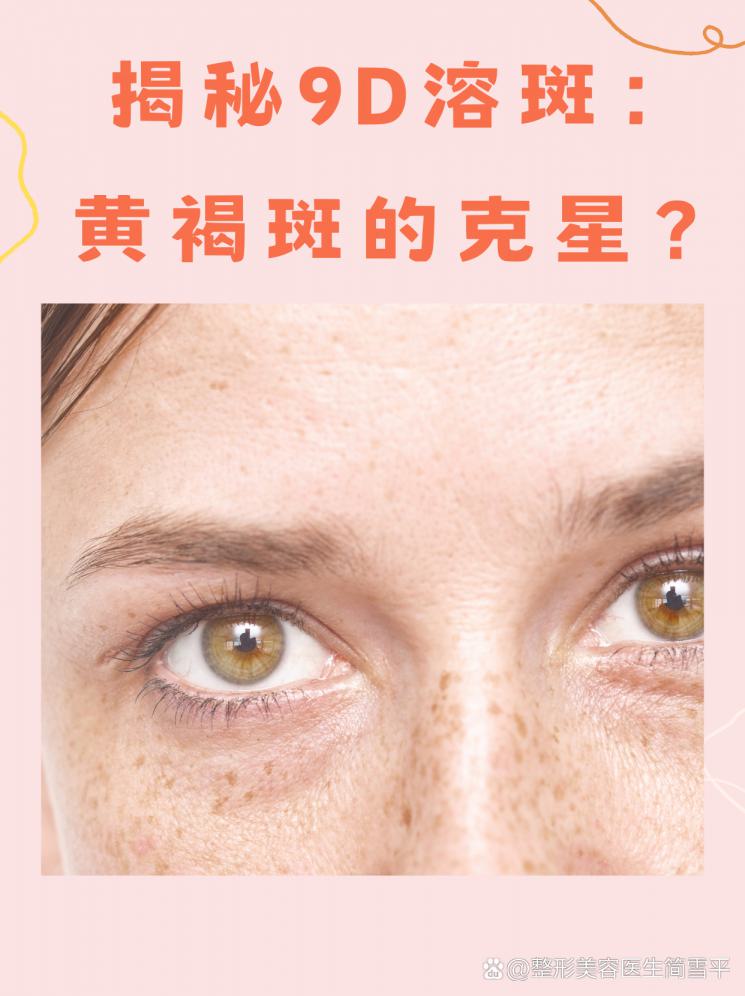 揭秘9D溶斑：黄褐斑的克星？