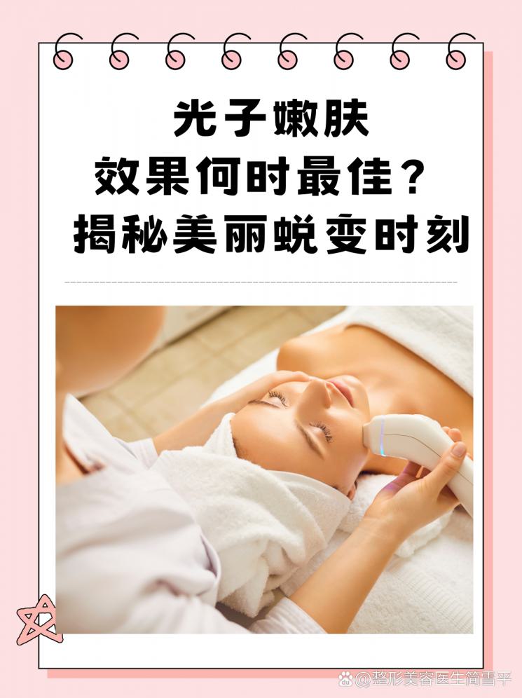 光子嫩肤效果何时最佳？揭秘美丽蜕变时刻