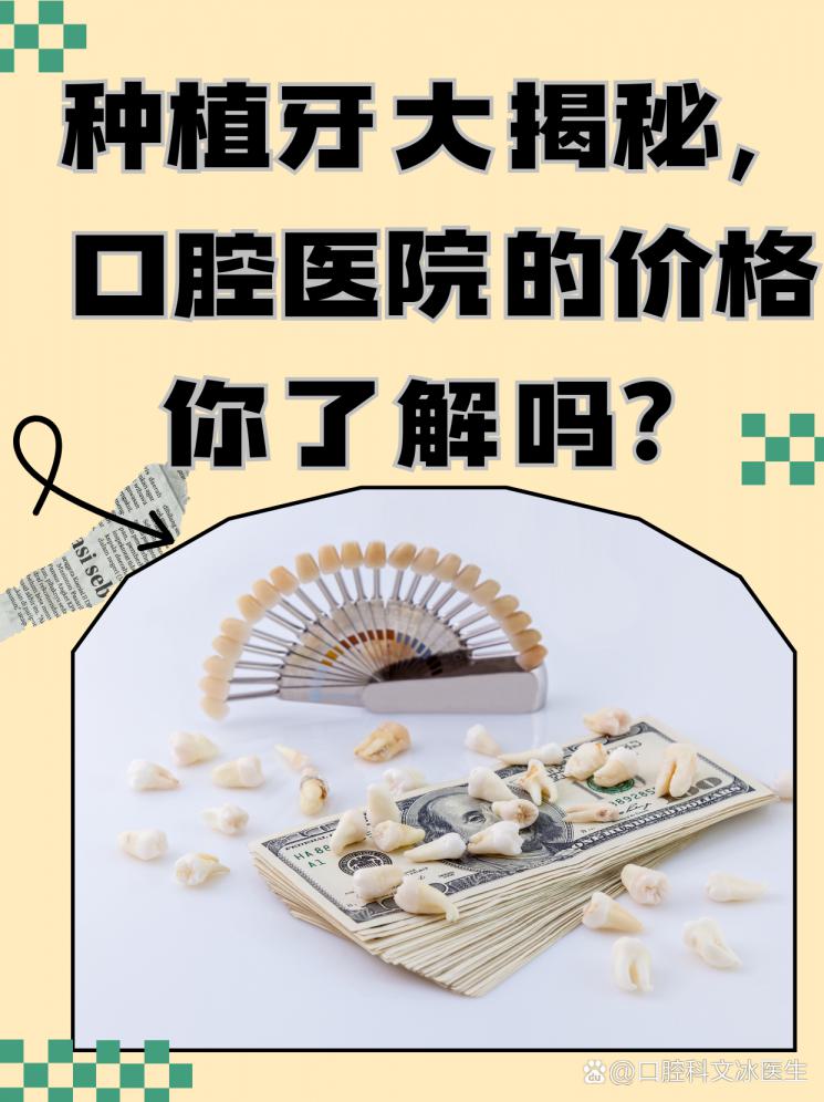 种植牙大揭秘，口腔医院的价格你了解吗？