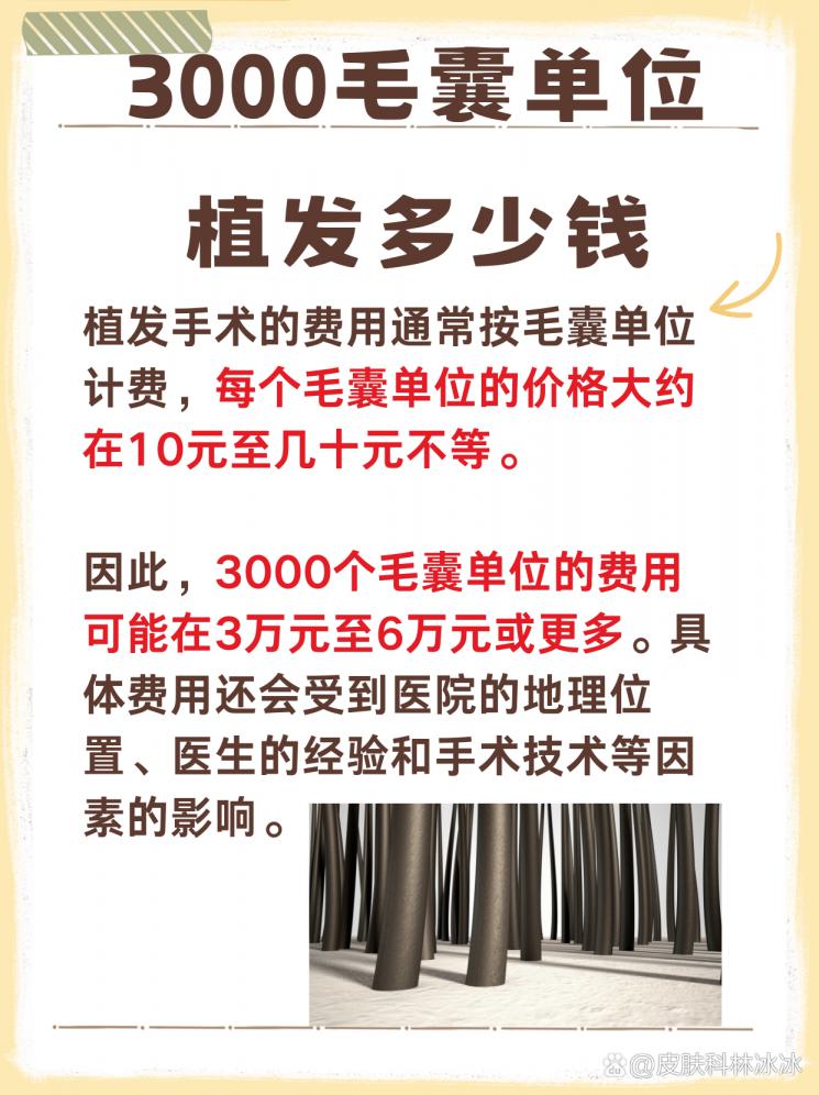 3000毛囊单位植发费用大揭秘，你的预算够吗？