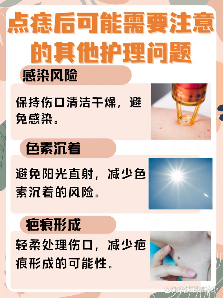 点痣后多久能碰水？恢复指南来了