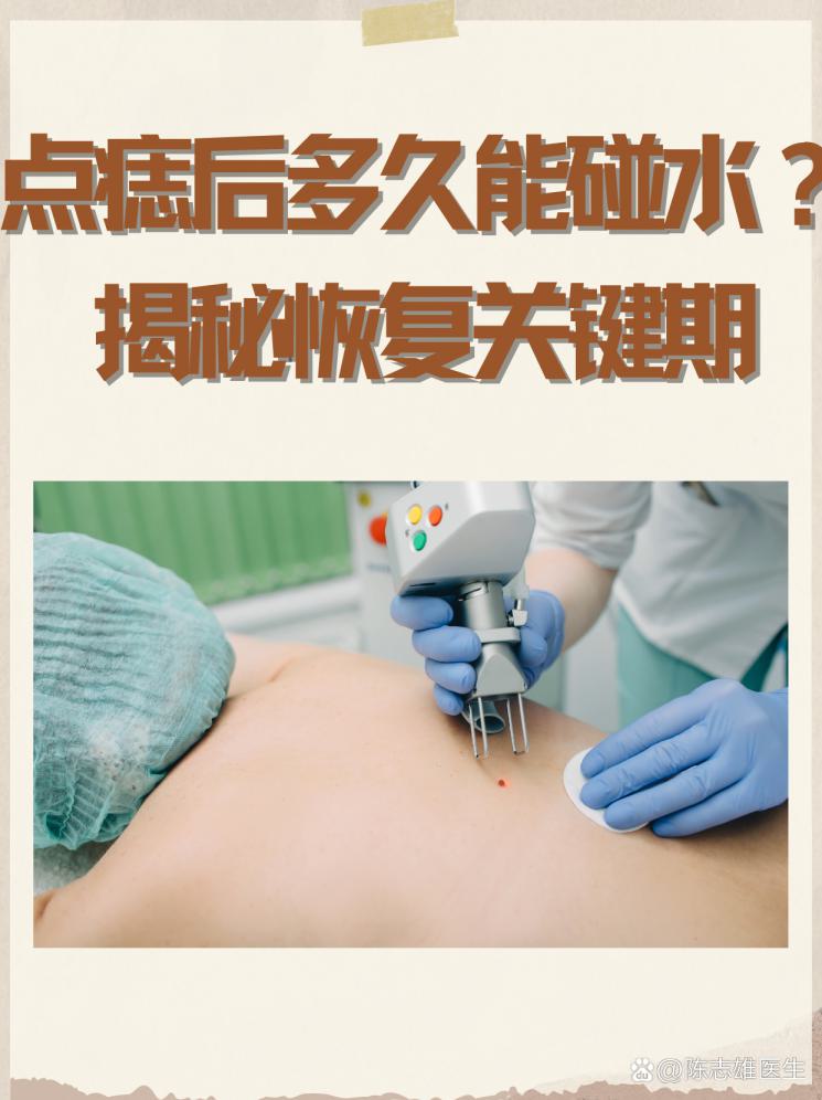 点痣后多久能碰水？揭秘恢复关键期