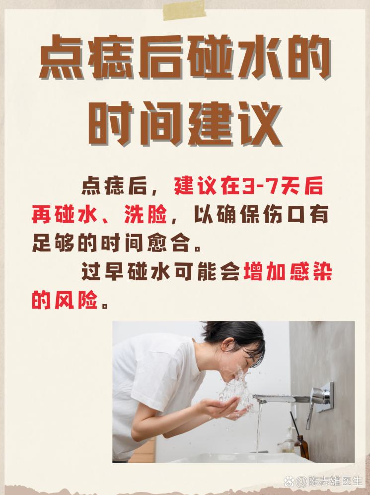 点痣后多久能碰水？揭秘恢复关键期