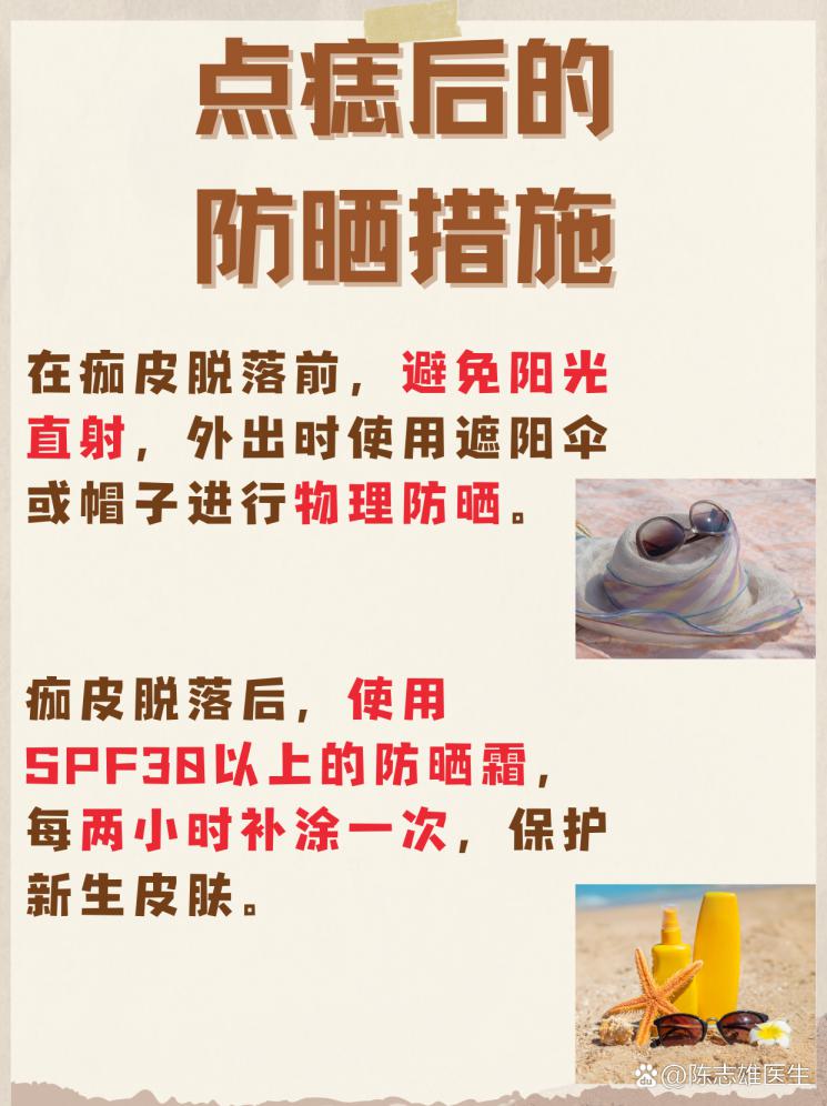 点痣后多久能碰水？揭秘恢复关键期