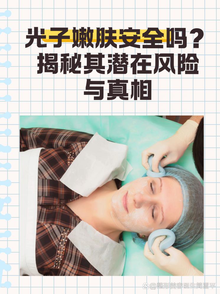 光子嫩肤安全吗？揭秘其潜在风险与真相