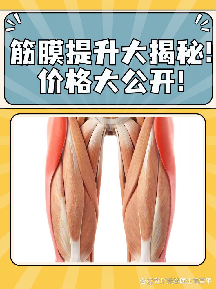 筋膜提升大揭秘！价格大公开！