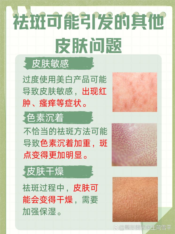 祛斑不反弹，一招教你永久告别斑点