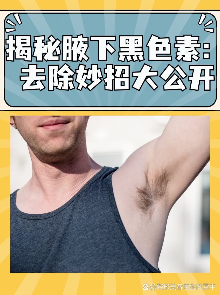 揭秘腋下黑色素：去除妙招大公开
