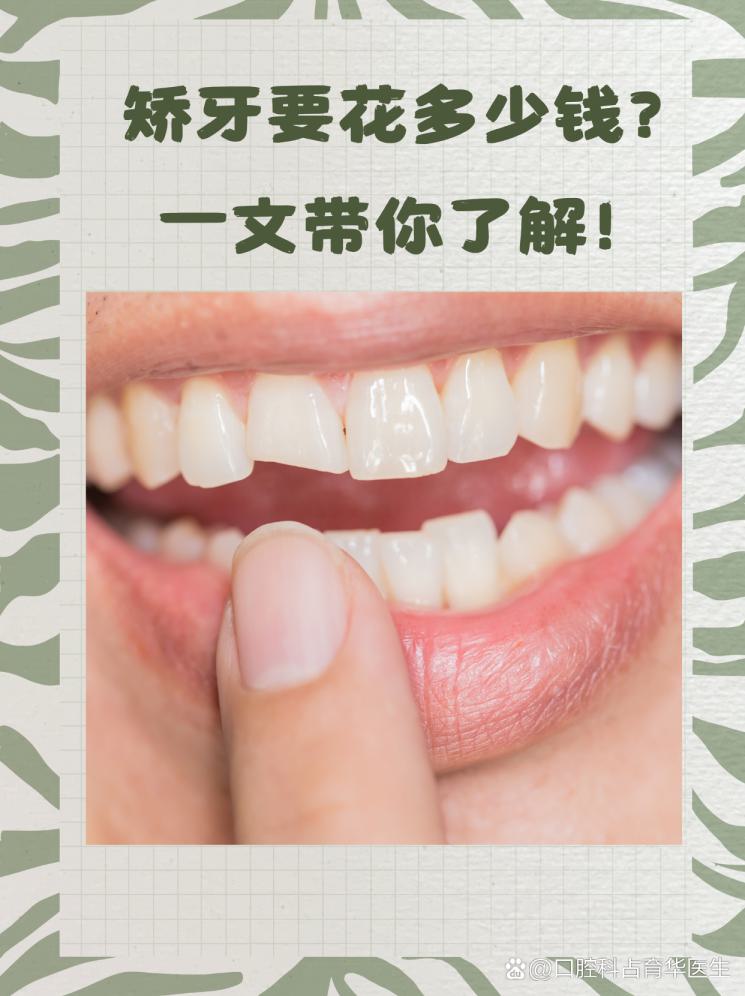 矫牙要花多少钱？一文带你了解！